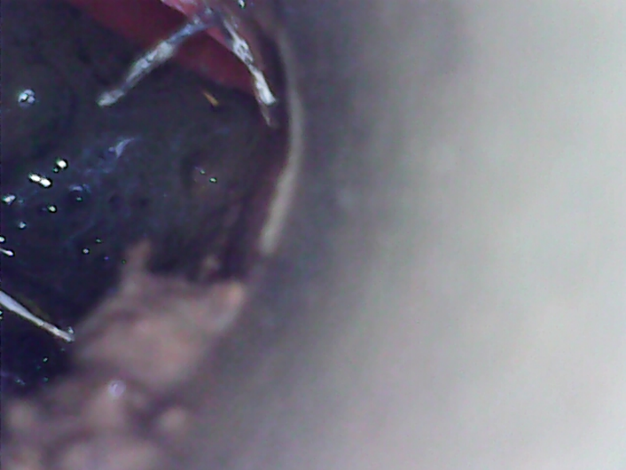 Biofilme na tubulação após início do tratamento (imagem capturada através de filmagem com endoscópio).